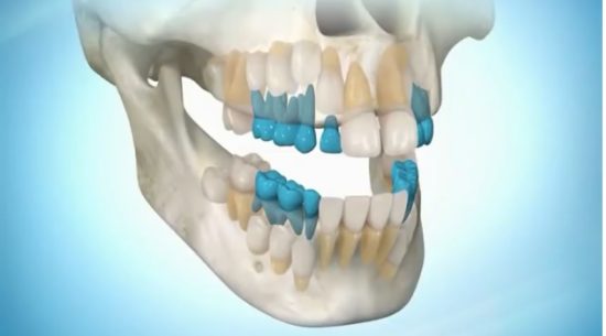 Практика-онлайн: регенерация новых, молодых зубов